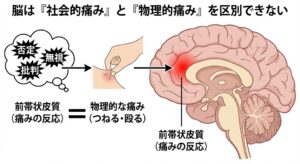 social-pain-physical-pain-brain-overlap-japanese.jpg